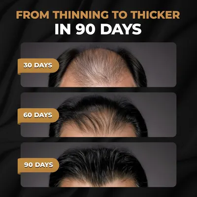 Visually demonstrates the product's effectiveness in promoting hair regrowth and increasing hair thickness over a 90-day period.