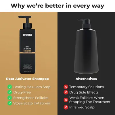 Compares the product's benefits to alternatives, positioning it as a superior, lasting, and drug-free solution for hair loss and scalp issues.
