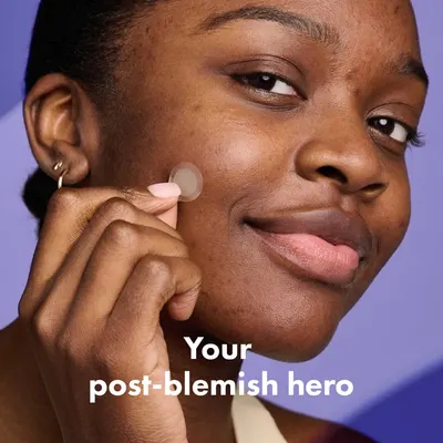 Highlights the product's ability to treat skin after blemishes, positioning it as a solution for post-acne care.