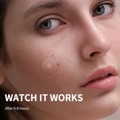 Demonstrates the effectiveness of the product in treating acne by showing a clear patch on a blemish, implying it will reduce or eliminate the spot.