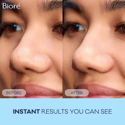 Demonstrates the immediate visible effect of the product in reducing the appearance of pores on the skin.