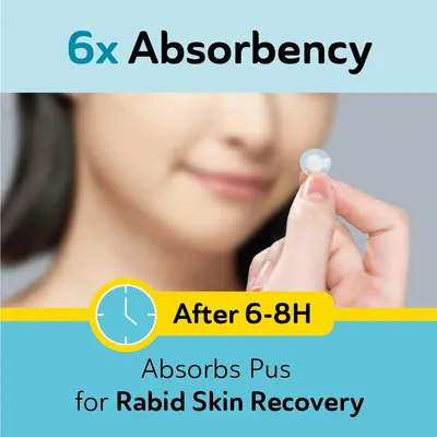 Highlights the product's superior absorbency and long-lasting effectiveness for skin treatment. Emphasizes the product's ability to absorb pus and promote…