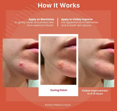 Demonstrates the process and effectiveness of applying the product to treat skin blemishes, showing visible improvement over time. Visually proves the…