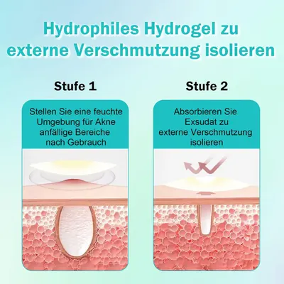 Explains the two-step process of how the hydrophilic hydrogel works to treat acne and absorb exudate.