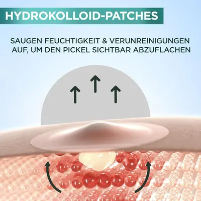 Demonstrates how the hydrocolloid patches absorb moisture and impurities to visibly reduce acne.