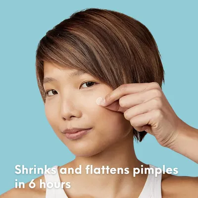 Demonstrates the product's ability to quickly reduce pimples, emphasizing its fast-acting nature for acne-prone skin.