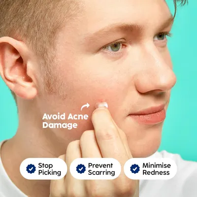 Highlights how the product helps avoid acne damage by stopping picking, preventing scarring, and minimizing redness.