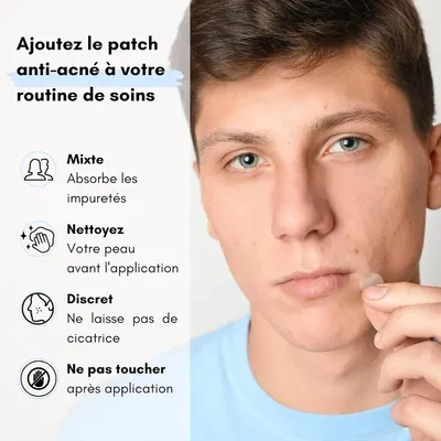 Secondary Images for Patch Acne