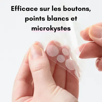 Highlights the product's effectiveness against specific skin issues like acne, whiteheads, and microcysts.