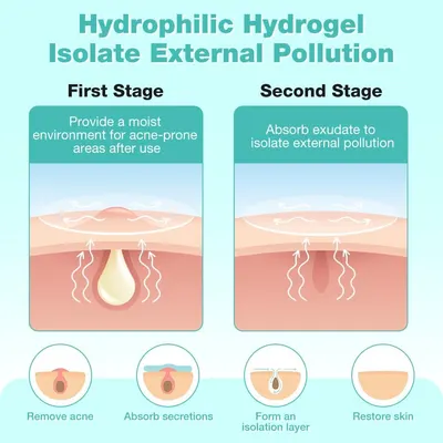 Explains the two-stage process of how the hydrophilic hydrogel works to treat acne and protect skin from external pollution. Showcases multiple benefits of…