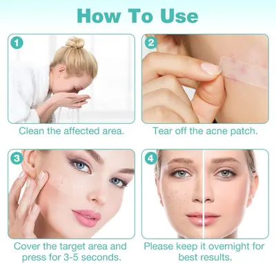 Provides step-by-step instructions on how to properly use and apply acne patches for best results.