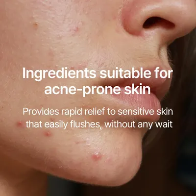 Highlights that the product contains ingredients suitable for acne-prone skin, providing rapid relief to sensitive skin.