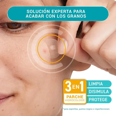Highlights the product's ability to effectively treat acne and blemishes using a 3-in-1 hydrocolloid patch solution.