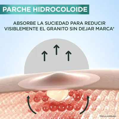 Demonstrates how the hydrocolloid patch absorbs impurities to visibly reduce acne without leaving marks.