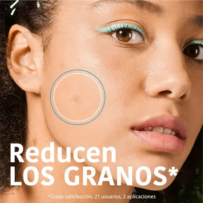 Highlights the product's ability to reduce acne or blemishes, showing a clear area of skin to demonstrate effectiveness.