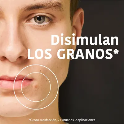 Highlights the product's ability to reduce or conceal acne, demonstrating its effectiveness for clear skin.