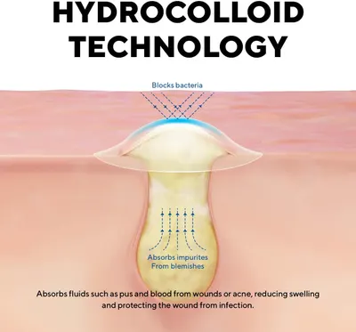 Explains how the hydrocolloid technology works to block bacteria and absorb impurities from blemishes, reducing swelling and protecting wounds from infection.