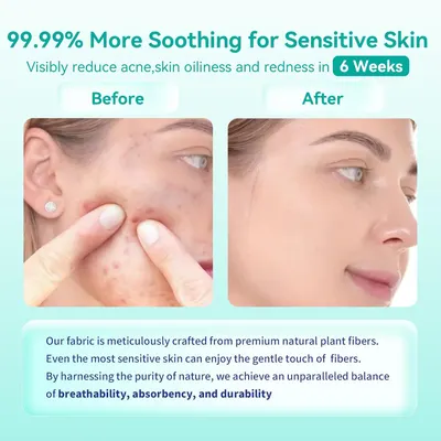 Demonstrates the product's effectiveness in reducing acne, skin oiliness, and redness for sensitive skin over a 6-week period. Highlights the product's superior soothing capability for sensitive…