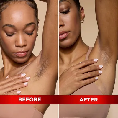 Demonstrates the effectiveness of the product in removing underarm hair, showing a clear before and after comparison.