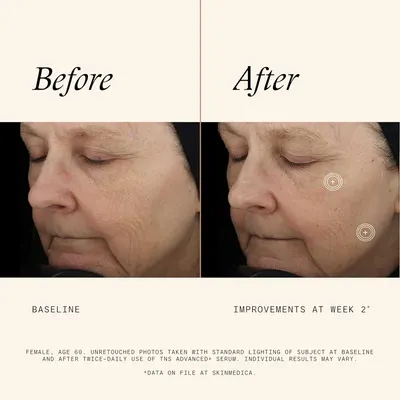 Demonstrates the effectiveness of the TNS Advanced+ Serum in improving skin appearance after 2 weeks of use.