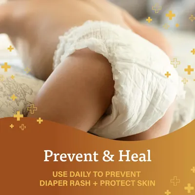 Highlights the product's ability to prevent and heal diaper rash, reassuring parents about protecting their baby's skin.
