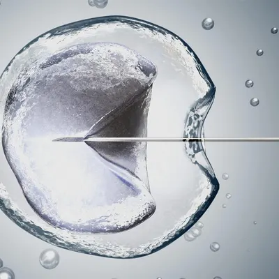 Provides a clean, professional visualization of a medical or scientific procedure (likely IVF/fertility treatment) to help shoppers understand the product's application in a real-world context…