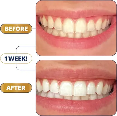 Demonstrates the visible whitening transformation achieved in just one week to prove product effectiveness and encourage purchase.