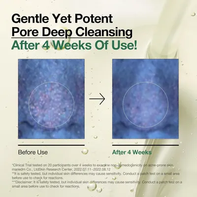 Demonstrates the visible transformation of skin after 4 weeks of product use, showing clearer pores and improved skin texture to prove product effectiveness.