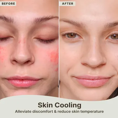 Demonstrates the product's effectiveness in reducing skin redness, inflammation, and discomfort by showing a clear visual transformation from irritated skin to calm, clear skin.