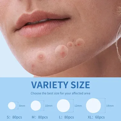 Demonstrates the different size options available (8mm, 10mm, 12mm, 14mm) to help shoppers choose the best size for their specific affected area, with quantity information for each size.
