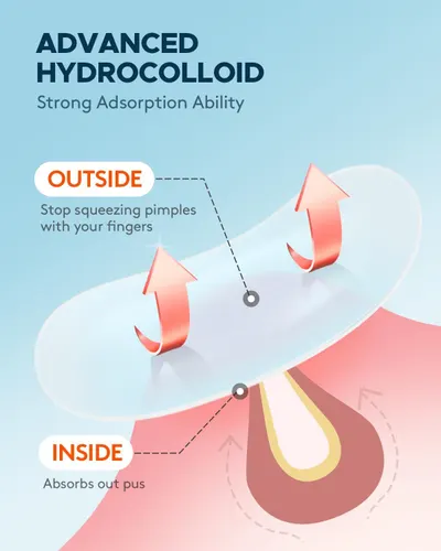 Educates shoppers on the correct way to use the product by showing that the hydrocolloid patch absorbs pus from inside the skin rather than requiring manual squeezing from outside, emphasizing…
