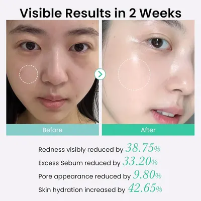 Demonstrates the transformative skincare results achieved in 2 weeks, showing visible improvements in redness, sebum, pores, and hydration to prove product effectiveness and build shopper…