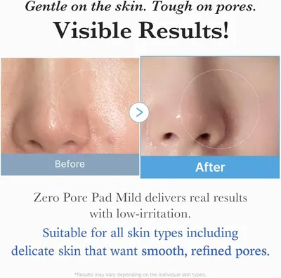 Demonstrates the visible transformation in skin texture and pore appearance after using the Zero Pore Pad Mild, proving the product's effectiveness at refining pores while being gentle on skin.