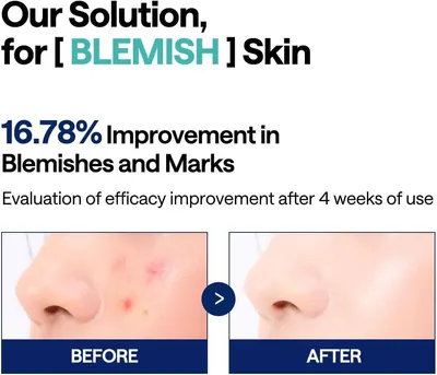 Demonstrates the product's effectiveness in reducing blemishes and marks by showing a clear visual transformation after 4 weeks of use, supported by a specific 16.78% improvement metric. Provides…