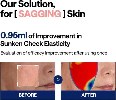 Demonstrates the product's effectiveness in improving sagging skin and sunken cheek elasticity by showing a measurable transformation after one use, building confidence in the product's anti-aging…