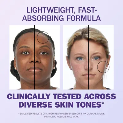 Demonstrates the visible transformation and effectiveness of the skincare product by showing before-and-after results on two different skin tones, reassuring shoppers that the product works across…