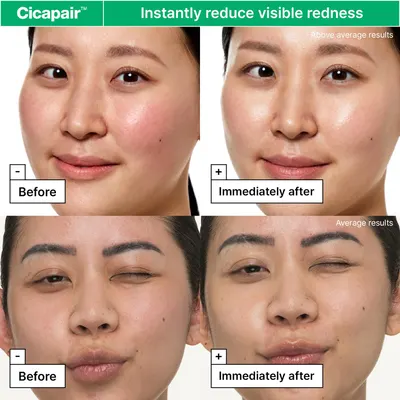 Secondary Images for Amazon.com: Dr.Jart+ Cicapair Sensitive Skin Face Moisturizer for Redness and Barrier…